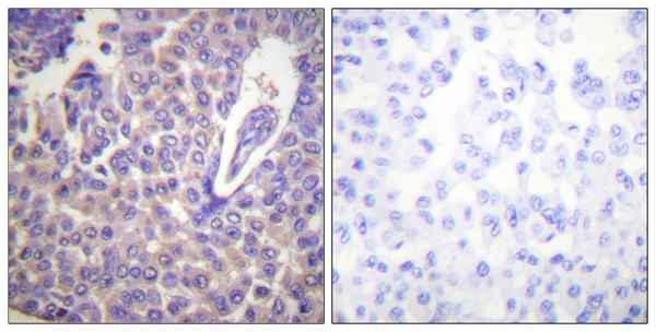 p-Calnexin (T456) Ab