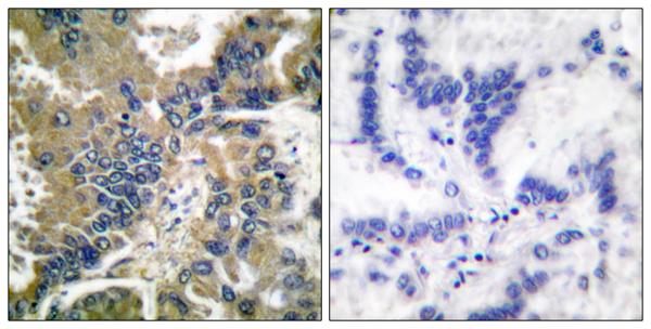 Cleaved-Caspase 1 p20 Ab