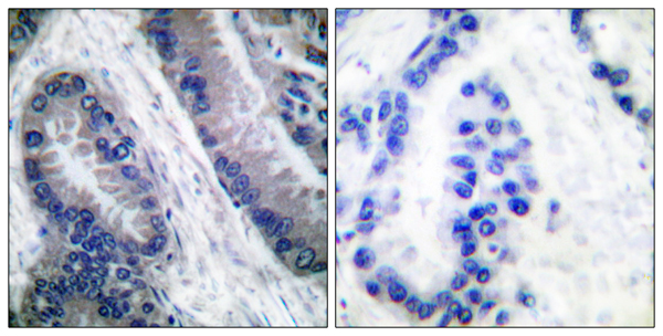 Cleaved-Caspase 1 p20 Ab