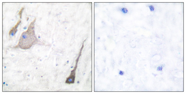 alpha Synuclein Ab