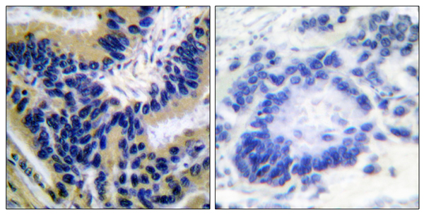 Cleaved-Caspase 3 p17 Ab