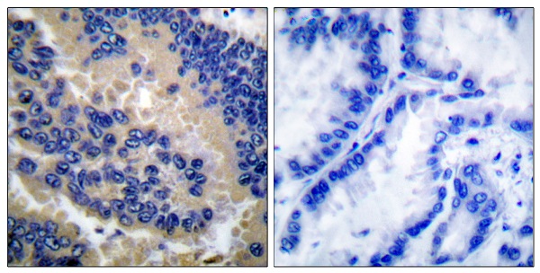 Cleaved-Caspase 3 p17 Ab