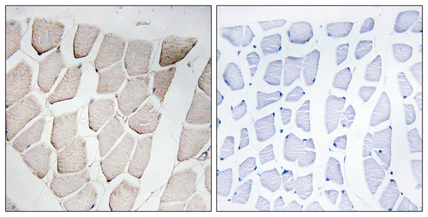 MYOM1 Ab