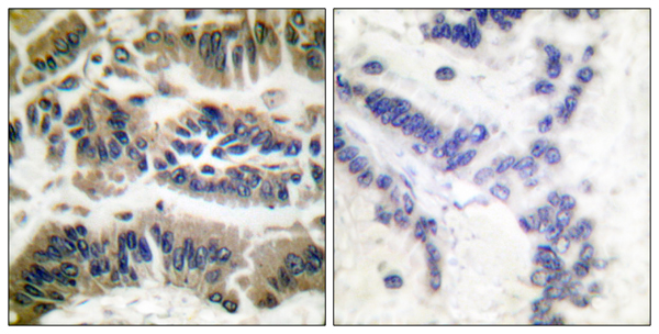 Caspase 6 Ab