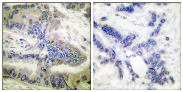 p-Caspase 6 (S257) Ab