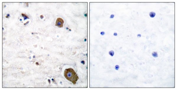 GDNF receptor alpha 1 Ab