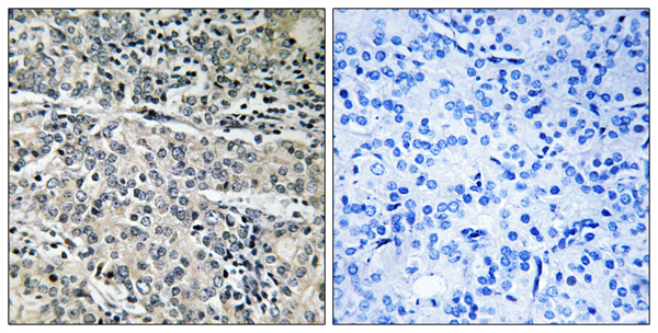 ATP5MJ Ab