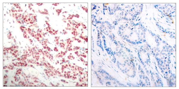 p-NF-kB p52 (S866) Ab