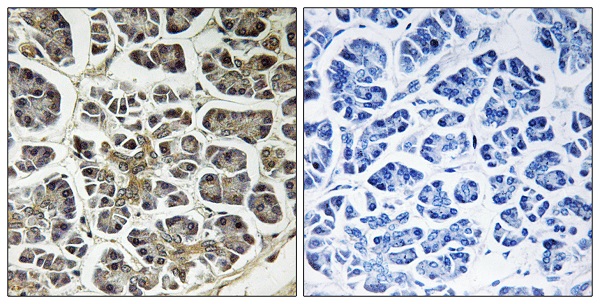 ATP5MC2 Ab