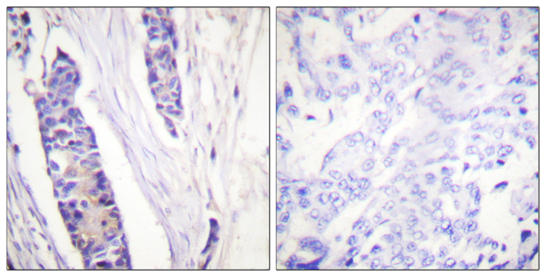 beta III Tubulin Ab