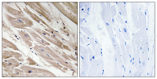 Cardiac MyBP C Ab