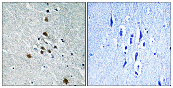 p-Splicing factor 1 (S82) Ab