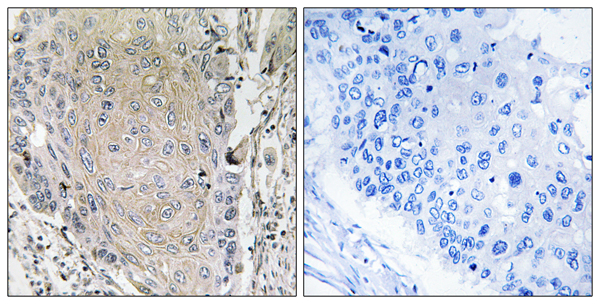 Cerebellin 3 Ab