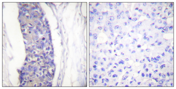 alpha 1A Tubulin Ab