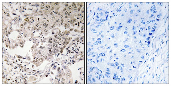 Condensin 2 complex subunit G2 Ab