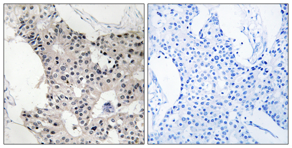 B melanoma antigen 4 Ab