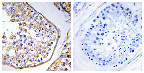 B melanoma antigen 3 Ab