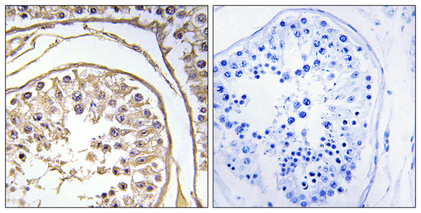 B melanoma antigen 2 Ab