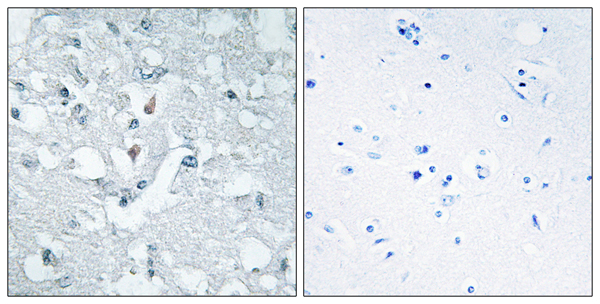 Glycerate kinase Ab