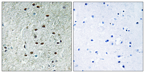 RNA exonuclease 1 homolog Ab