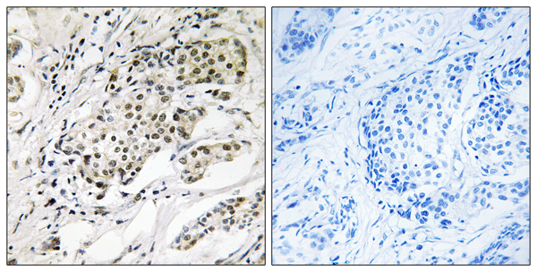 Chromodomain Y like protein 2 Ab