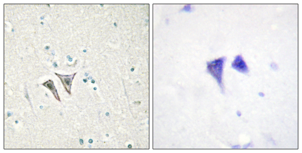 Activin receptor type 1C Ab