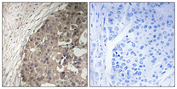 CsGalNAcT 1 Ab