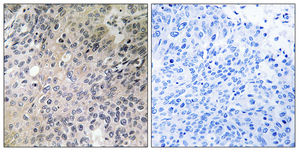 SHC transforming protein 3 Ab