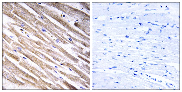 Ribosomal protein uL3 like Ab