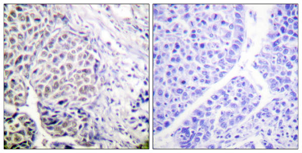 p-Aurora kinase B (Y12) Ab