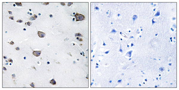 Apoptosis inducing factor 3 Ab