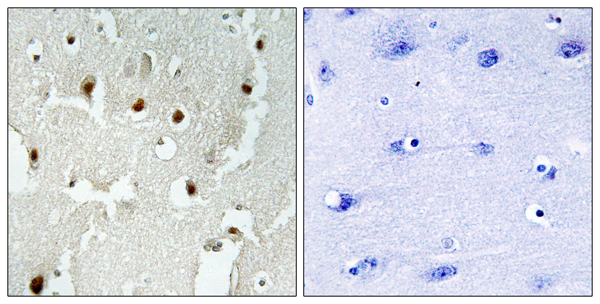 Transcriptional regulating factor 1 Ab