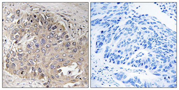 beta V spectrin Ab