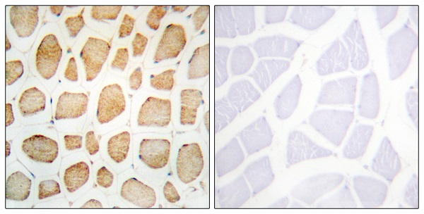 alpha Actinin 2/3 Ab