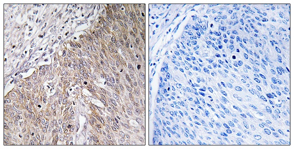 Apolipoprotein L2 Ab