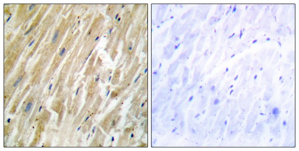 Calreticulin Ab