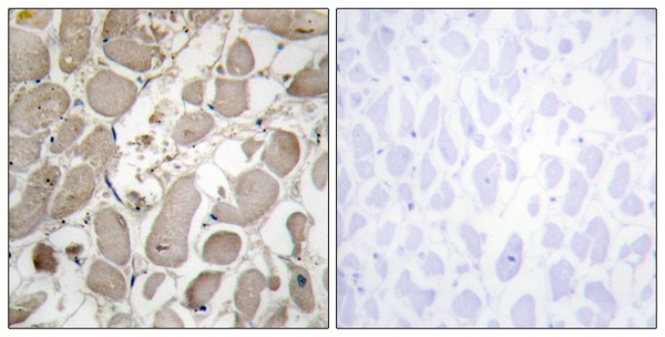 Collagen V alpha 1 Ab