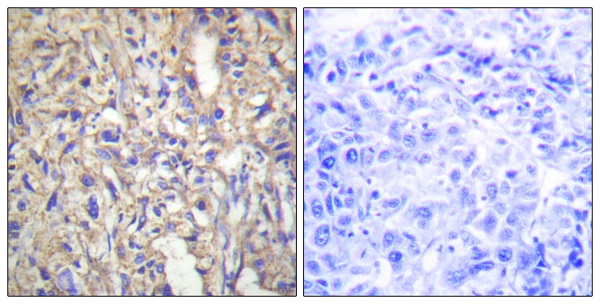 Laminin beta 1 Ab