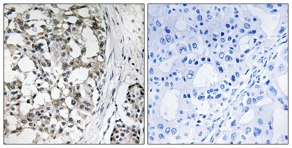 Peroxin 14 Ab