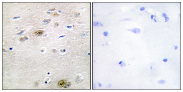 TRA 2 alpha Ab