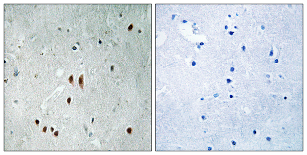 p-CNOT2 (S101) Ab