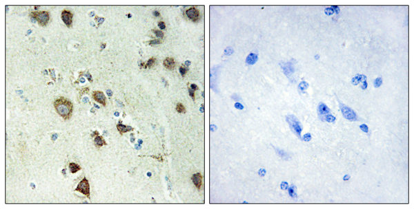 p90 S6 kinase alpha 6 Ab