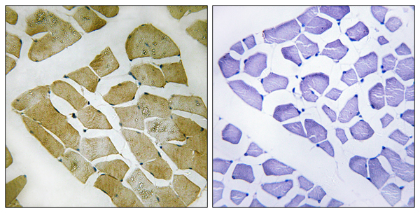 Myosin heavy chain 2b Ab