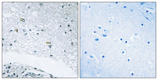 Laminin gamma 3 Ab