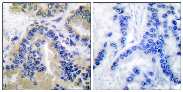 Caspase 10 Ab