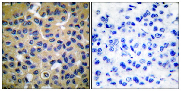 Collagen II alpha 1 Ab