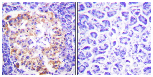 Collagen III alpha 1 Ab