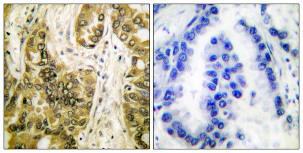 Galectin 3 Ab