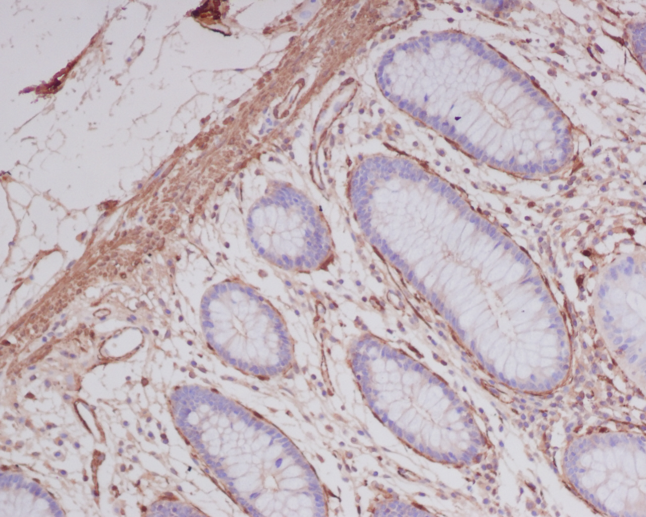 alpha Smooth muscle actin Ab