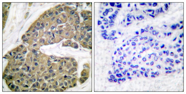 Cytokeratin 5 Ab